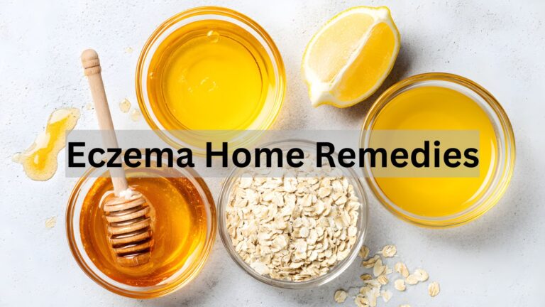 Eczema Home Remedies Dermatologists Secretly Love for Fast Relief Eczema Home Remedies Dermatologists Love for Fast Relief