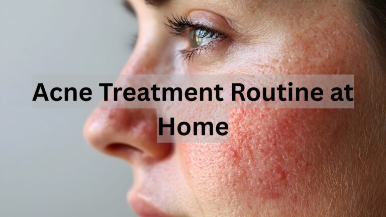 Effective Acne Treatment Routine at Home for All Skin Types